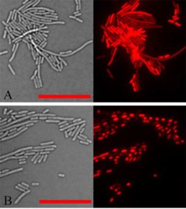 New model antibacterial mechanism nano digest