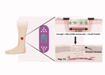 Rapid and effective healing of diabetic ulcers