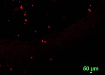 Microplastics exposed in Auckland air, Nano Digest.