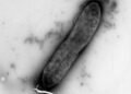 Silver nanoparticles show promise in the fight against drug-resistant bacteria. Nano Digest.