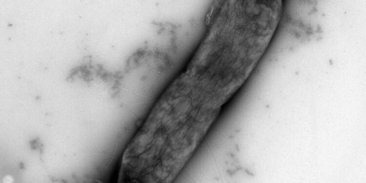 Silver nanoparticles show promise in the fight against drug-resistant bacteria. Nano Digest.