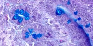 Food coloring and Certain Food Nanoparticles can affect the Human gut. Nano Digest.