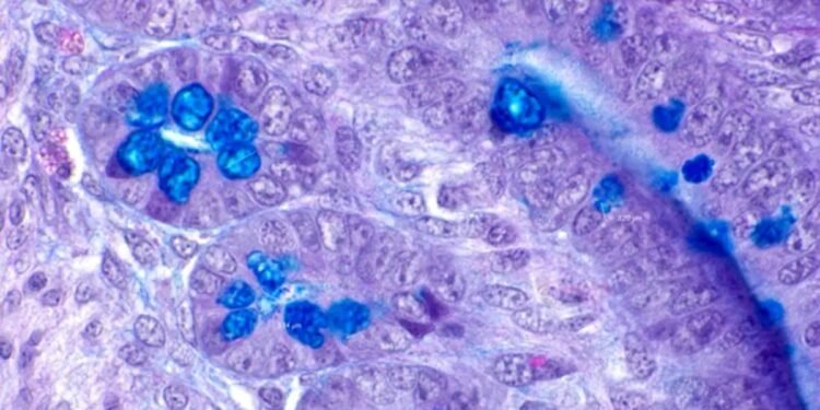 Food coloring and Certain Food Nanoparticles can affect the Human gut. Nano Digest.