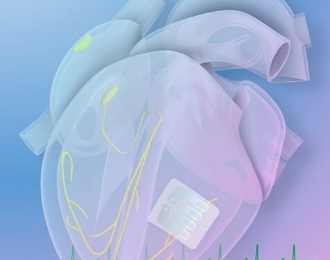 Thinnest Cardiac Implant on a Tattoo Paper. Nano Digest.