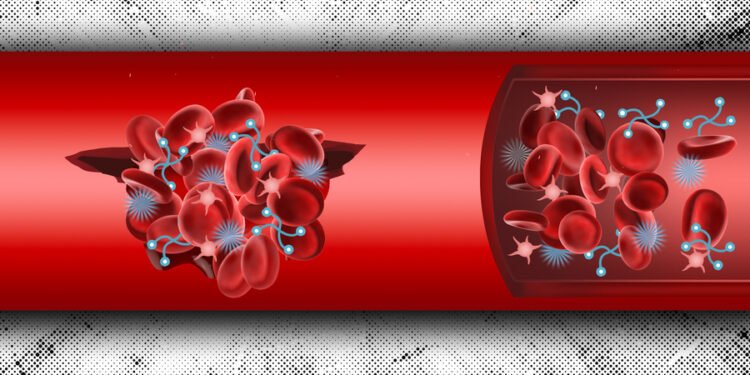 A new way to halt internal bleeding. Nano Digest.