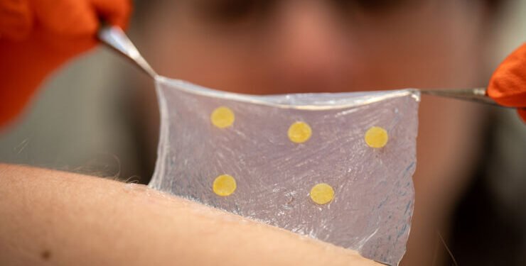 A New Type of Wound Care. Nano Digest.