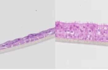 Scientists build human lungs in boxes to test drugs. Nano Digest.