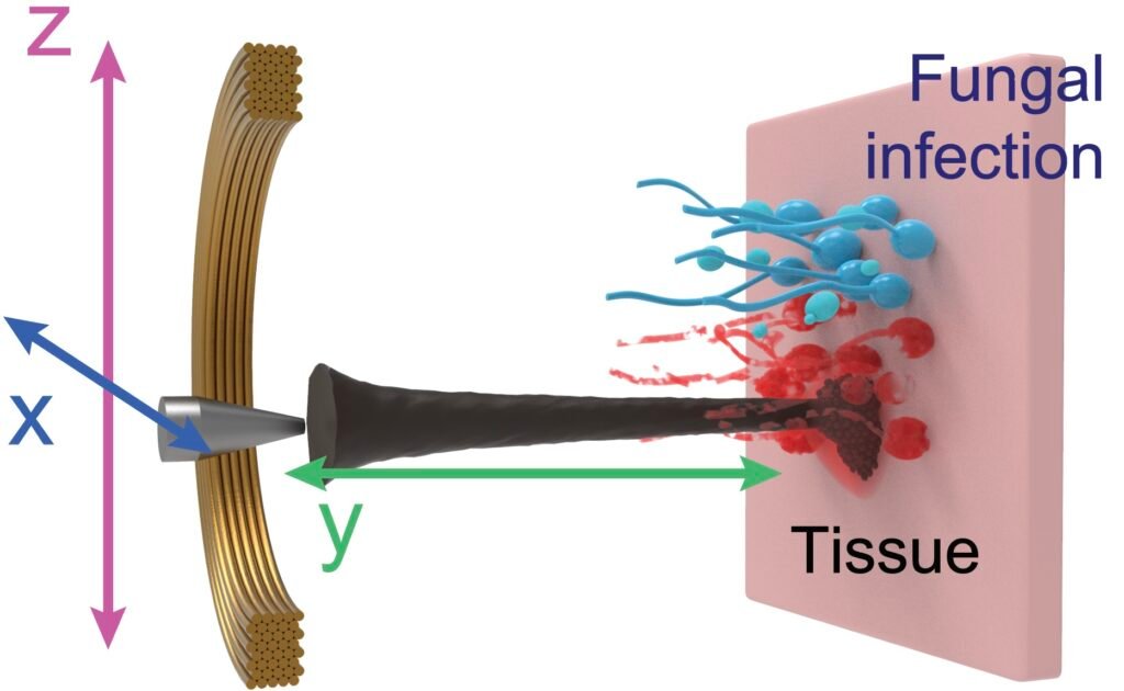 New way to Quickly Eliminate Fungal Infections. Nano Digest.