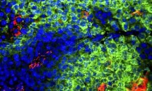 Nanotechnology paves the way for cancer-fighting T cells. Nano Digest.
