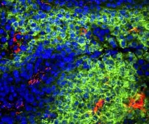 Nanotechnology paves the way for cancer-fighting T cells. Nano Digest.