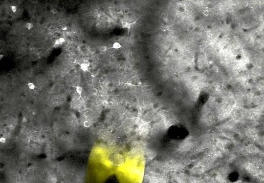 Flexible nanoelectrodes can provide effective brain stimulation. Nano Digest.