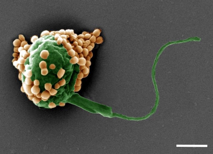 It’s Hard to Get Meds to the Lungs: Breathable Algae Offers a New Path.