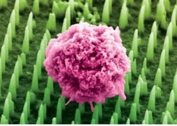 Nanoneedles patch for painless Cancer Biopsies