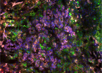 Biomarker identifies the risk of liver cancer