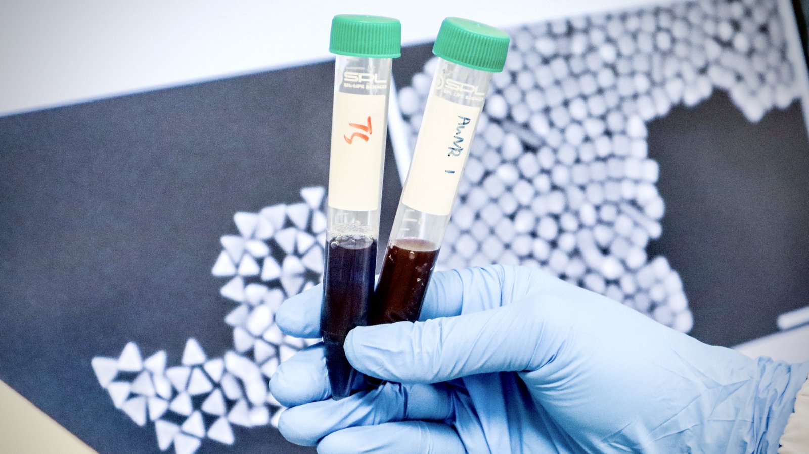 “Barcodes” help gold nanoparticles to strike cancer energy centres