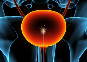 A new sensor might help find bladder cancer earlier