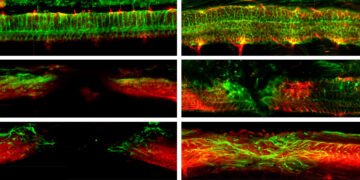 Microrobots repair spinal cord